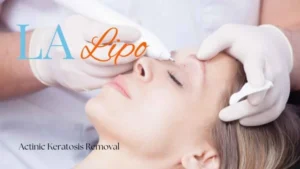 Woman receiving Actinic Keratosis Removal Treatment Bexley