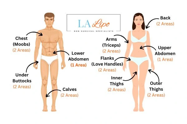 LA LIPO Cryolipolysis Areas Bexley