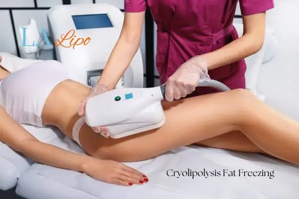 Woman receiving coolsculpting Bexley treatment on her thighs