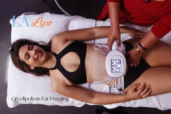 woman getting cryolipolysis Bexley