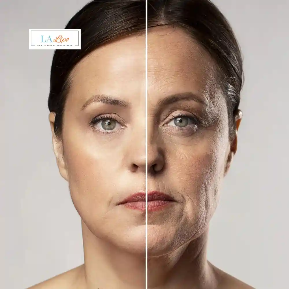 How Can You Tell If Non-Surgical Skin Tightening Is Right for You Bexley?