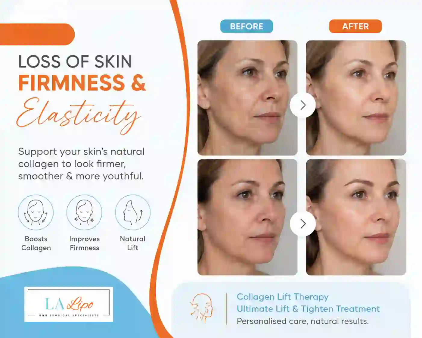 Sign #7: Loss of Skin Firmness and Elasticity Bexley