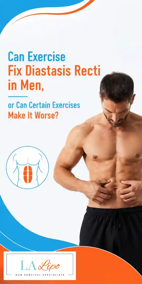 Can Exercise Fix Diastasis Recti in Men, or Can Certain Exercises Make It Worse Bexley?