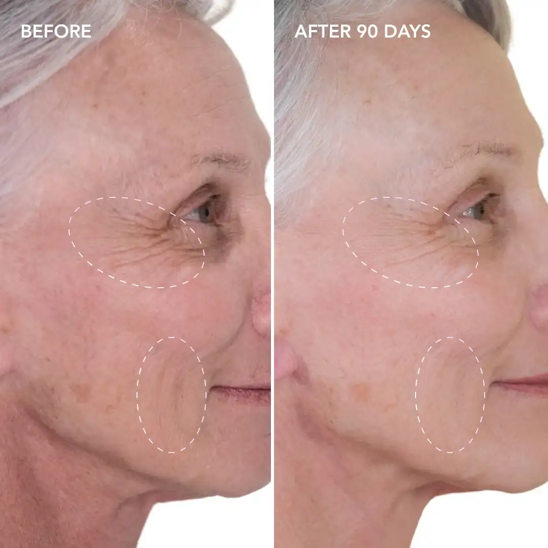 When will you see results Bexley